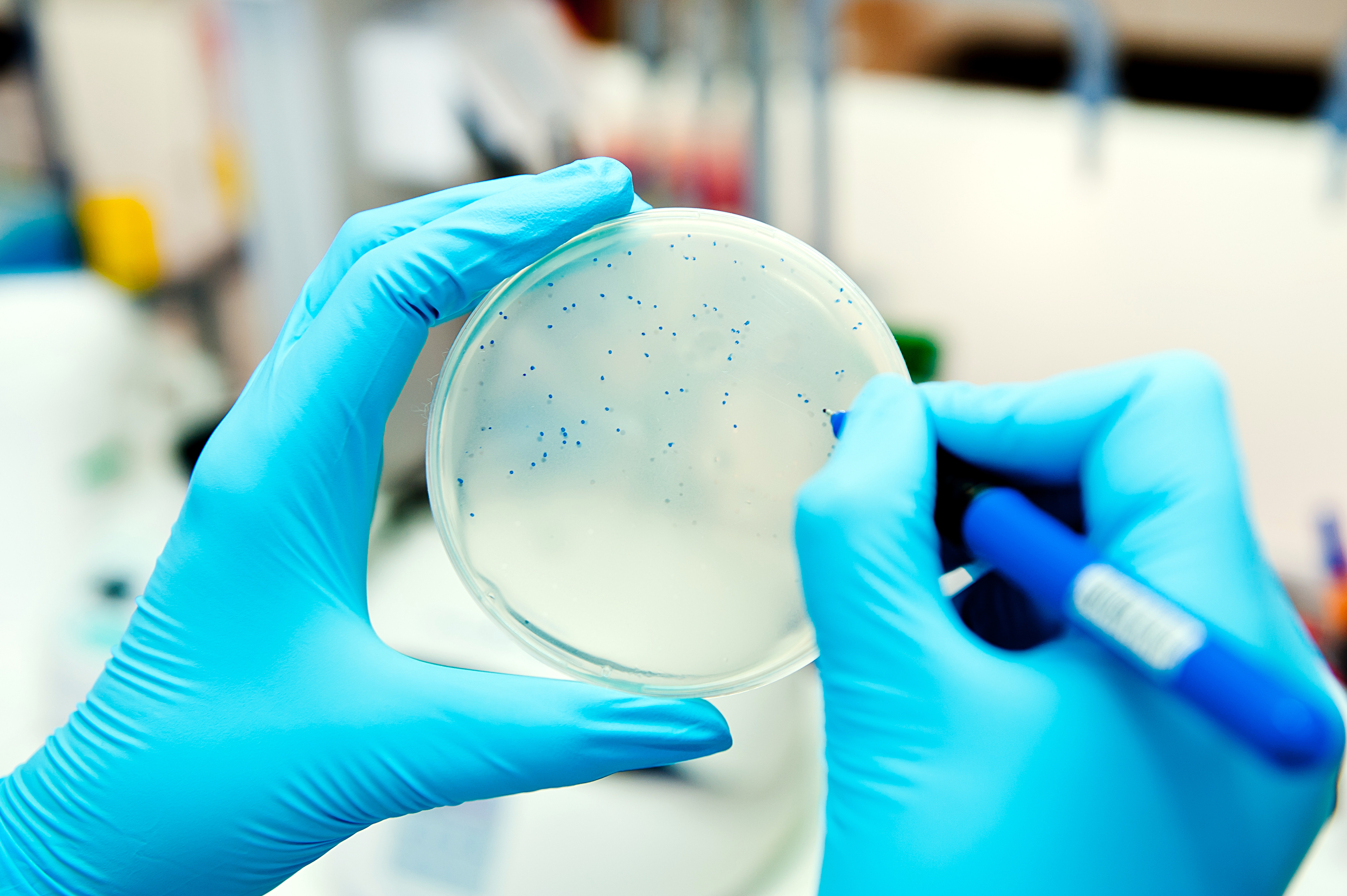 Scientist counting phage plaques